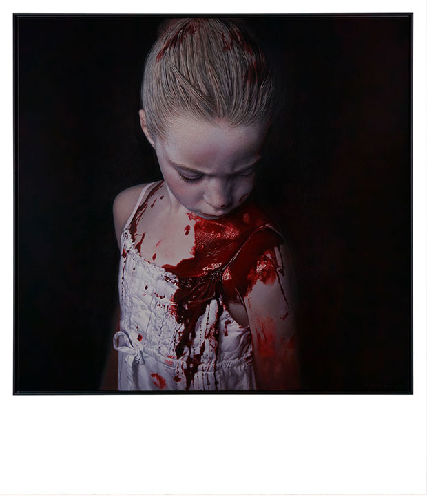 Gottfried Helnwein - The Disasters of War 34 - 2014